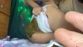 Two Dirty Diapers